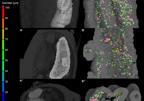 Mikroplasty v akvarijních zebřičkách: Mikro-CT jako nedestruktivní způsob zobrazování mikroplastů v biologických vzorcích